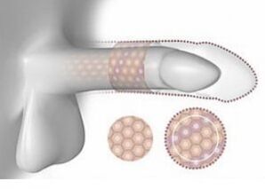 Increase the penis in volume